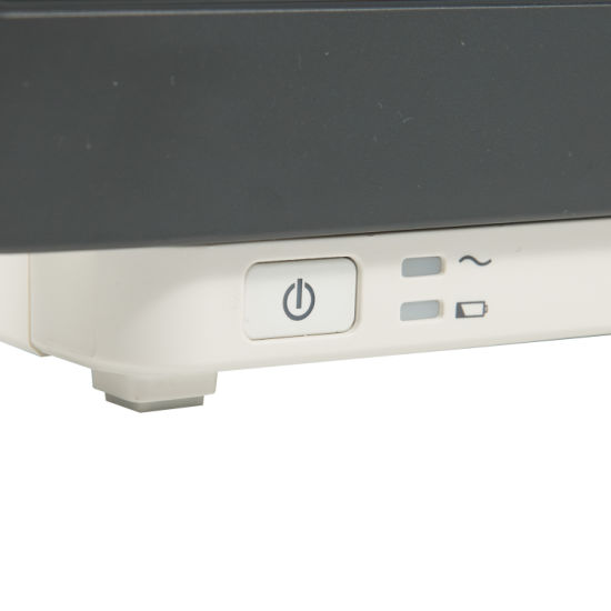 (MS-8800) Monitor de paciente multiparámetro portátil de hospital con pantalla táctil